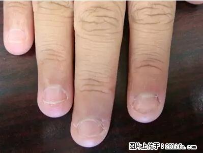 剪指甲、挖耳屎，这些日常小动作竟隐藏大危害！ - 抚州生活资讯 - 抚州28生活网 fuzhou.28life.net